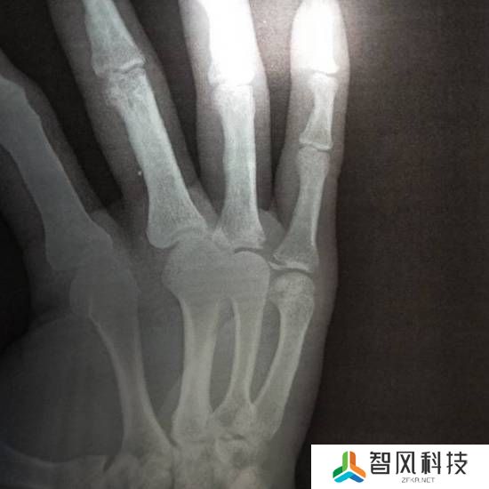 本站